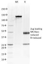 Albumin (Transport Protein) (ALB/2144), 1mg/mL