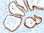 Cytokeratin, Basic (Type II or HMW)(KRTH/2147R), 1mg/mL
