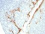 Cytokeratin 16 (KRT16) (Suprabasal Keratinocyte Marker) (rKRT16/1714), 1mg/mL