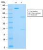 Cytokeratin 16 (KRT16) (Suprabasal Keratinocyte Marker) (rKRT16/1714), 1mg/mL