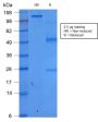 Ep-CAM / CD326 (Extracellular Domain) (Epithelial Marker) (rEGP40/1372), 1mg/mL