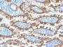 Cytokeratin 8 (KRT8) (KRT8/2174R), 1mg/mL