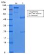 Cytokeratin 8 (KRT8) (KRT8/2174R), 1mg/mL
