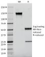 EGFR (Epidermal Growth Factor Receptor)(F4), 1mg/mL