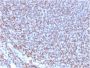 NKX2.2 (Neuroendocrine & Ewing's Sarcoma Marker)(NX2/2198R), 1mg/mL
