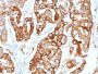 Cytokeratin 7 (Glandular and Transitional Epithelial Marker)(KRT7/2200), 1mg/mL