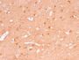 PGP9.5 / UchL1 (pan-Neuronal Marker) (rUCHL1/775), 1mg/mL