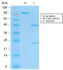 PGP9.5 / UchL1 (pan-Neuronal Marker) (rUCHL1/775), 1mg/mL