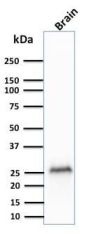 PGP9.5 / UchL1 (pan-Neuronal Marker) (rUCHL1/775), 1mg/mL