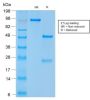 CD56 / NCAM1 / NKH1 (Neuronal Cell Marker) (NCAM1/2217R), 1mg/mL