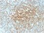 Bcl-2 (Apoptosis & Follicular Lymphoma Marker) (rBCL2/782), 1mg/mL