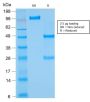 Bcl-2 (Apoptosis & Follicular Lymphoma Marker) (rBCL2/782), 1mg/mL