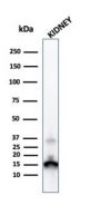 Transthyretin (Prealbumin)(CPTC-TTR-1), 1mg/mL