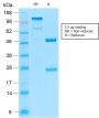 Insulin Receptor Alpha (INSR/2277R), 1mg/mL