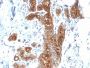 MUC1 / CA15-3 / EMA / CD227 (Epithelial Marker) (MUC1/2278R), 1mg/mL
