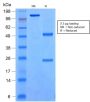 SOX9 / SRY-box 9(rSOX9/2288), 1mg/mL