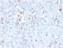 p21WAF1 (Tumor Suppressor Protein)(rCIP1/823), 1mg/mL