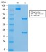 MUC18 / CD146 / MCAM (Melanoma Cell Adhesion Molecule) (rMUC18/1130), 1mg/mL