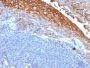 MUC18 / CD146 / MCAM (Melanoma Cell Adhesion Molecule) (rMUC18/1130), 1mg/mL