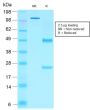NKX2.2 (Neuroendocrine & Ewing s Sarcoma Marker) (rNX2/1523), 1mg/mL
