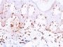 Collagen VII(LH7.2), 1mg/mL