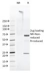 FAT1 (FAT atypical cadherin 1)(FAT1-3D7/1), 1mg/mL