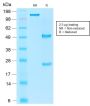 Ep-CAM / CD326 (Epithelial Marker) (rEGP40/1110), 1mg/mL