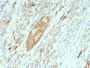 GAD2 / GAD65 (GABAergic Neuronal Marker)(GAD2/2362), 1mg/mL