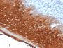 Cytokeratin 6A (KRT6A) (Basal Cell Marker) (KRT6A/2368), 1mg/mL