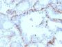 Cytokeratin 6A (KRT6A) (Basal Cell Marker) (KRT6A/2368), 1mg/mL