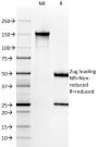 Cytokeratin 6A (KRT6A) (Basal Cell Marker) (KRT6A/2368), 1mg/mL