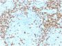 CD5 (Mantle Cell Lymphoma Marker)(CD5/2418), 1mg/mL
