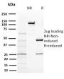 BAP1 (BRCA1 Associated Protein 1)(BAP1/2431), 1mg/mL