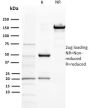 BAP1 (BRCA1 Associated Protein 1)(BAP1/2432), 1mg/mL