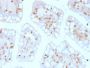 CD103 / Integrin alpha E (T-Cell Lymphoma & Hairy Cell Leukemia Marker) (ITGAE/2474), 1mg/mL
