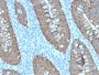 Ep-CAM / CD326 (Extracellular Domain) (Epithelial Marker)(EGP40/2571R), 1mg/mL