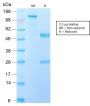 EGFRvIII (Epidermal Growth Factor Receptor, Variant III) (GFR/2600R), 1mg/mL