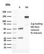 BAP1 (BRCA1 Associated Protein 1)(BAP1/2667), 1mg/mL