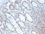 BMI1 (Oncogene and Stem Cell Marker)(BMI1/2690), 1mg/mL