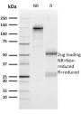 n-Myc (Neuroblastoma Marker)(NMYC-1), 1mg/mL