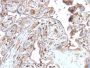 S100A4 (Marker of Tumor Metastasis) (S100A4/2750R), 1mg/mL