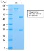 S100A4 (Marker of Tumor Metastasis) (S100A4/2750R), 1mg/mL