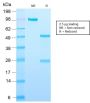 Adipophilin / Perilipin-2 (Marker of Lipid Accumulation) (ADFP/2755R), 1mg/mL