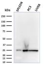 C1QA / Complement C1q A-Chain(C1QA/2783), 1mg/mL