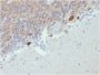 Calretinin / Calbindin 2 (Mesothelioma Marker)(CALB2/2807), 1mg/mL