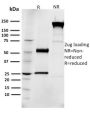 EGFR (Epidermal Growth Factor Receptor)(R1), 1mg/mL