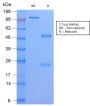 HLA-DP (MHC II)(HLA-DPB1/2862R), 1mg/mL