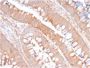 CD59 / Complement Regulatory Protein / Protectin (MACIF/2867R), 1mg/mL