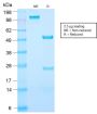 Prostate Specific Antigen (PSA) (KLK3/2871R), 1mg/mL