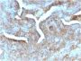 Thymidine Phosphorylase / PD-ECGF (Angiogenesis Marker) (TYMP/2890R), 1mg/mL